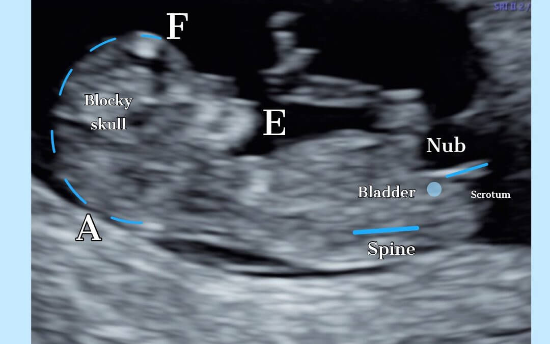 Null & Skull Predictions Baby Gender Pro