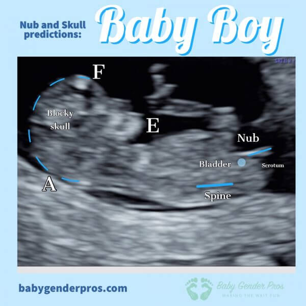 Null & Skull Predictions Baby Gender Pro