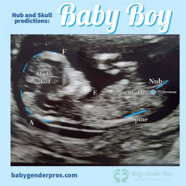 nub-and-skull-predictions-baby-gender-pro