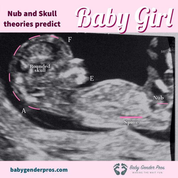 nub-&-skull-theories-predicts-girl-1-scan