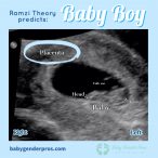 Ramzi Theory Gender Prediction | Baby Gender Pros