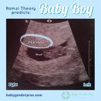 Ramzi Theory Gender Prediction | Baby Gender Pros