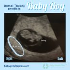 Ramzi Theory Gender Prediction | Baby Gender Pros