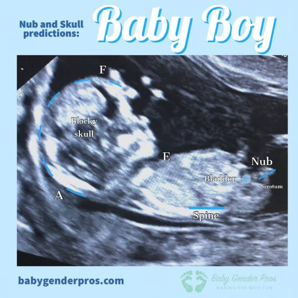null-and-skull-predictions-baby-gender-pro