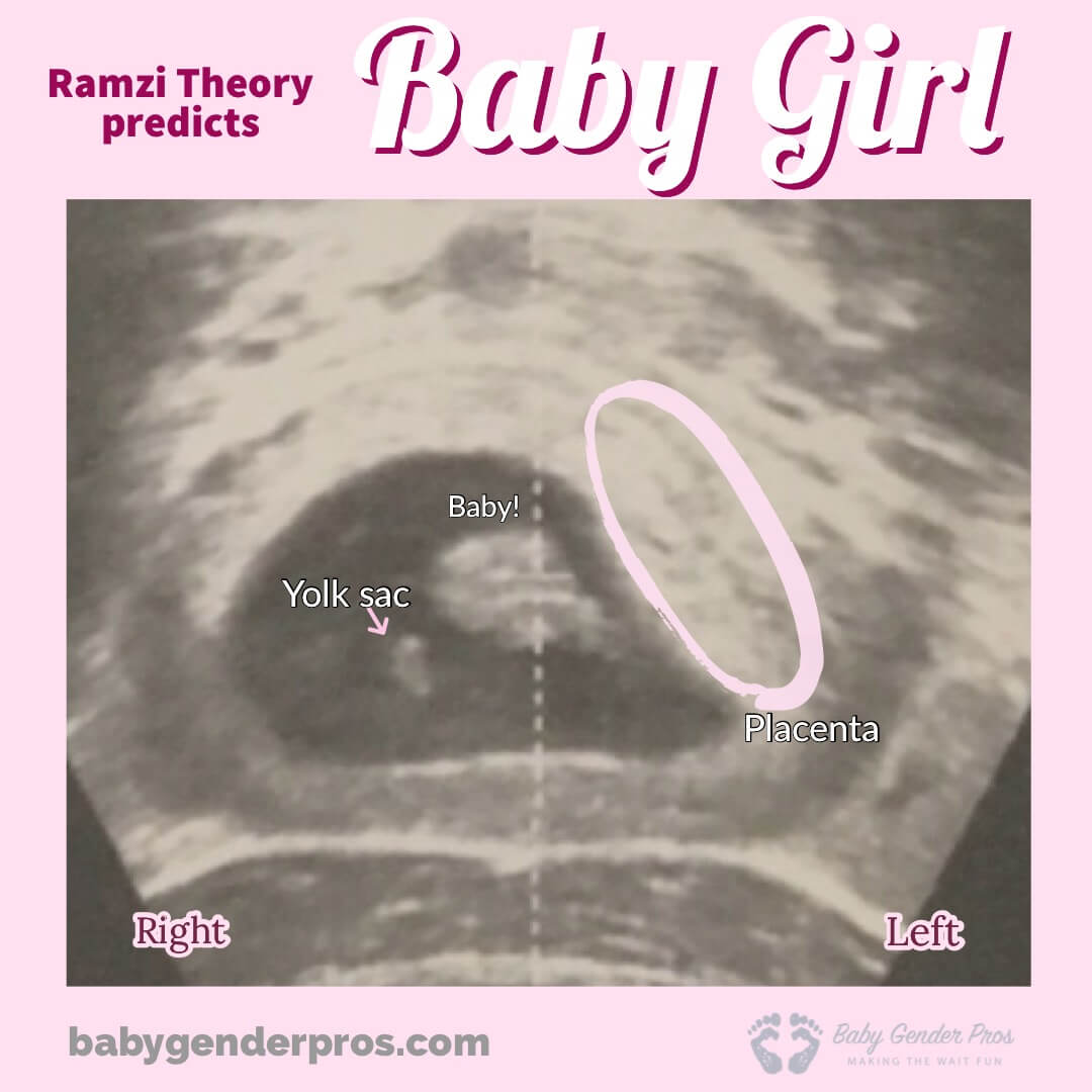 Ramzi Prediction - Baby Gender Pro