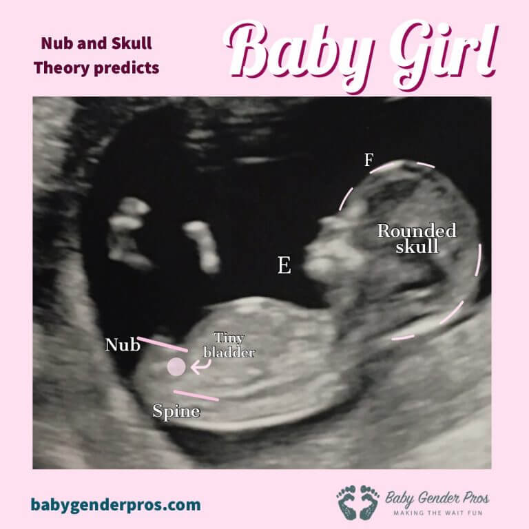 The Evidence Supporting the Skull Theory Baby Gender Pros