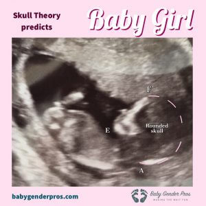 Baby Gender Predictor Tests | Ramzi, Nub & Skull Theories | Try Today