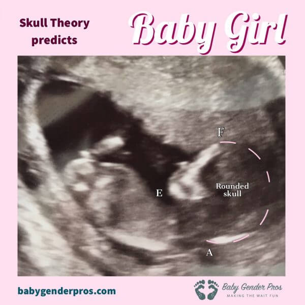 Baby Gender Predictor Tests Ramzi Nub Skull Theory Try Today