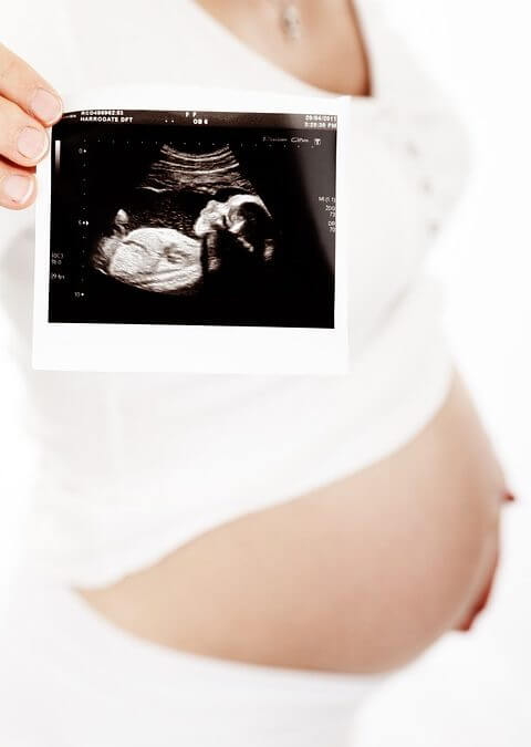 Woman Holding Baby Ultrasound