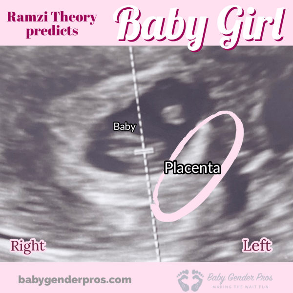 6 week ultrasound with ramzi theory gender prediction
